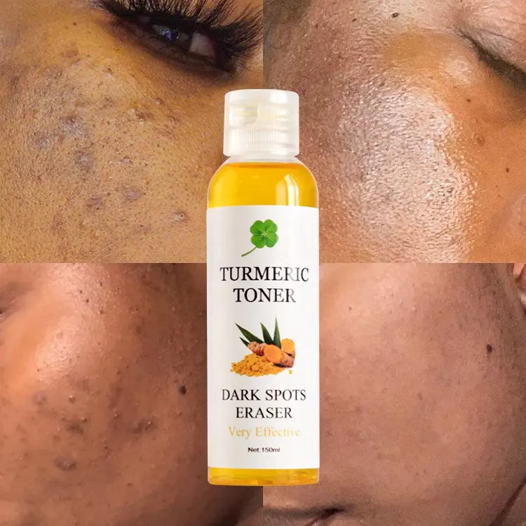 Organic Turmeric Toner Facial Care Anti-Acne Pimple Removal Skin