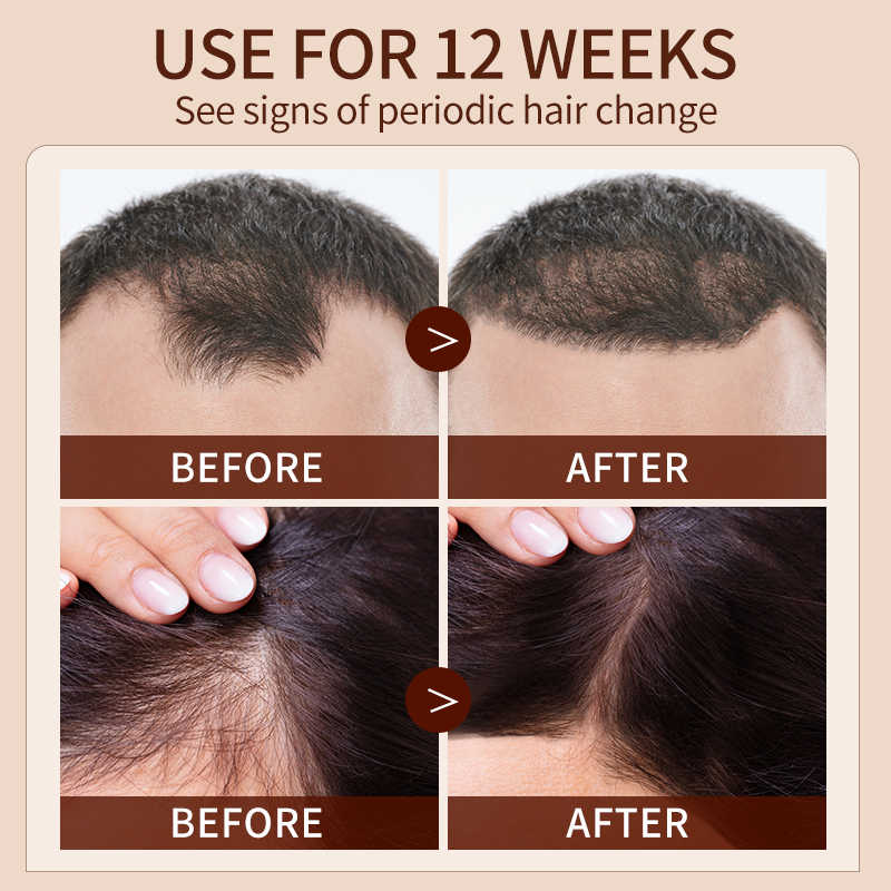 Natural Hair Growth Elixir – Herbal Scalp & Hair Care Oil (50ml)